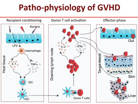 gcvhg|Acute graft.